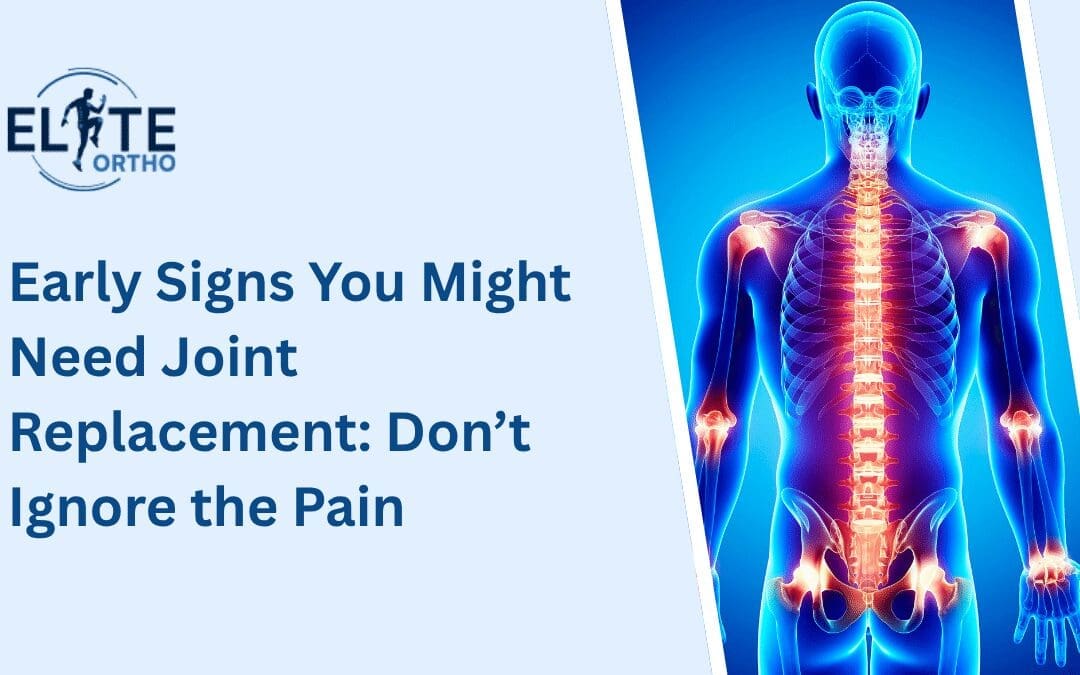 Early Signs You Might Need Joint Replacement: Don’t Ignore the Pain