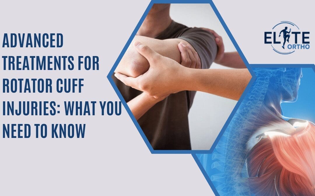 Advanced Treatments for Rotator Cuff Injuries: What You Need to Know