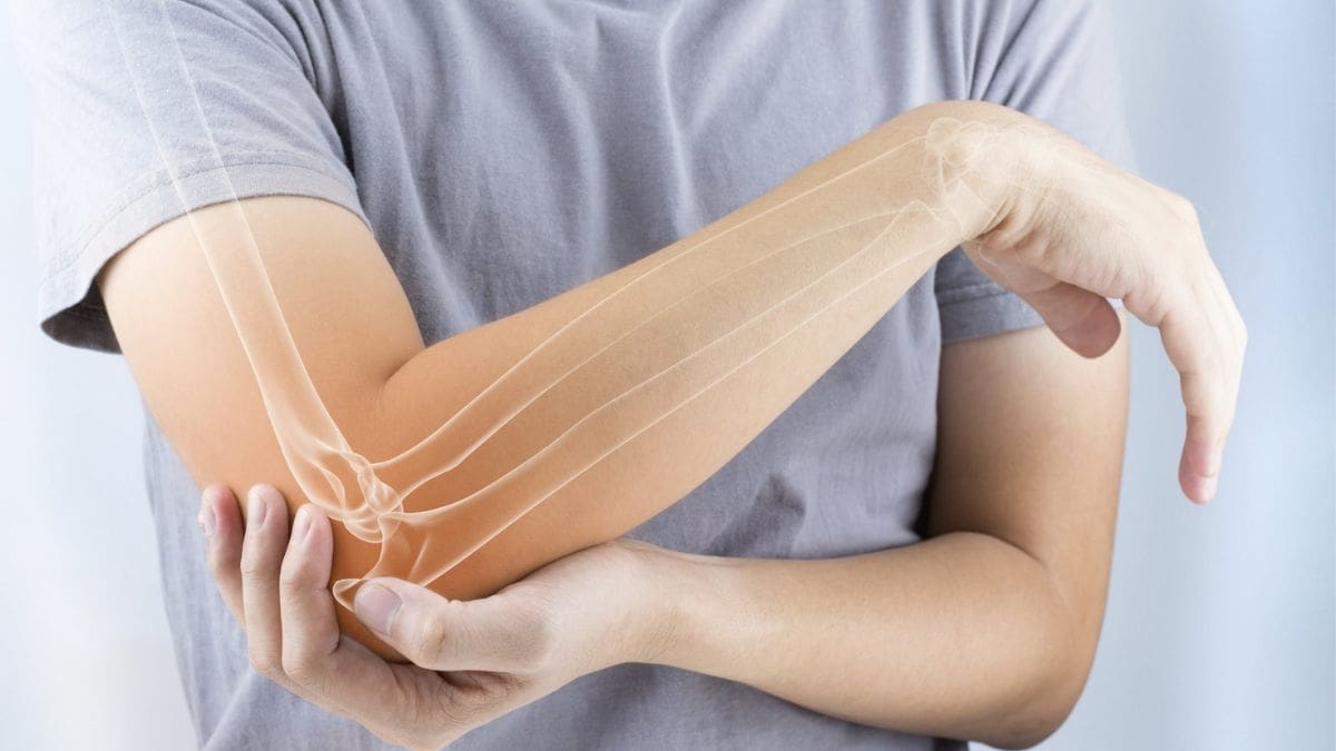 Elbow Dislocation