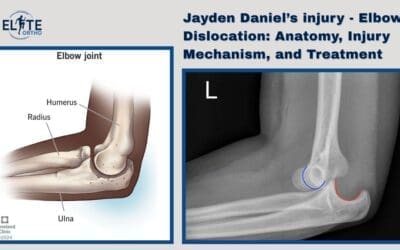 Jayden Daniel’s injury – Elbow Dislocation: Anatomy, Injury Mechanism, and Treatment