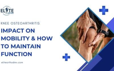 Knee Osteoarthritis: Impact on Mobility & How to Maintain Function