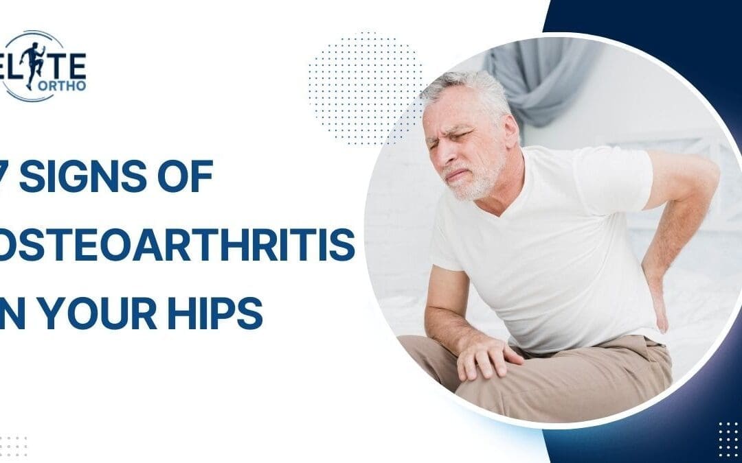 7 Signs of Osteoarthritis in Your Hips